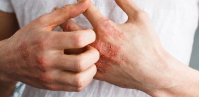 Tips On House Cleaning For People with Fingers Eczema